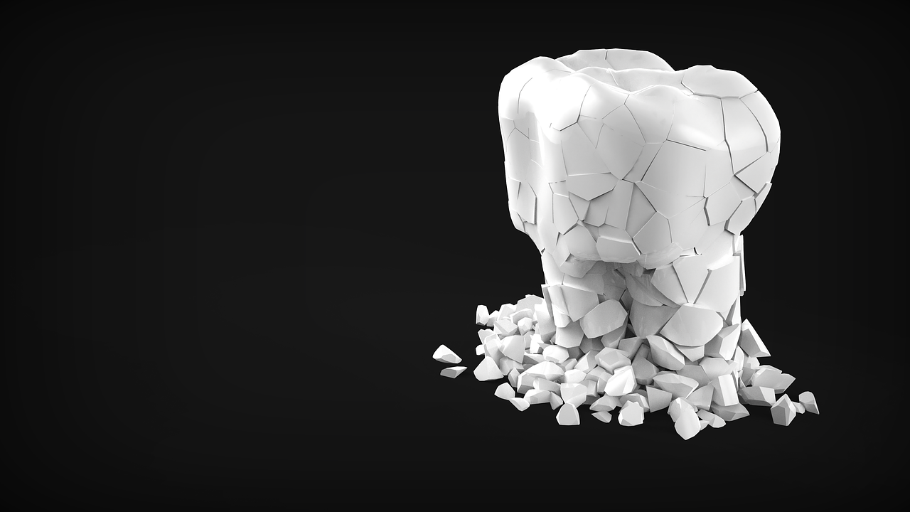 Nuskilo priekinis dantis – kaip greitai jį sutvarkyti?